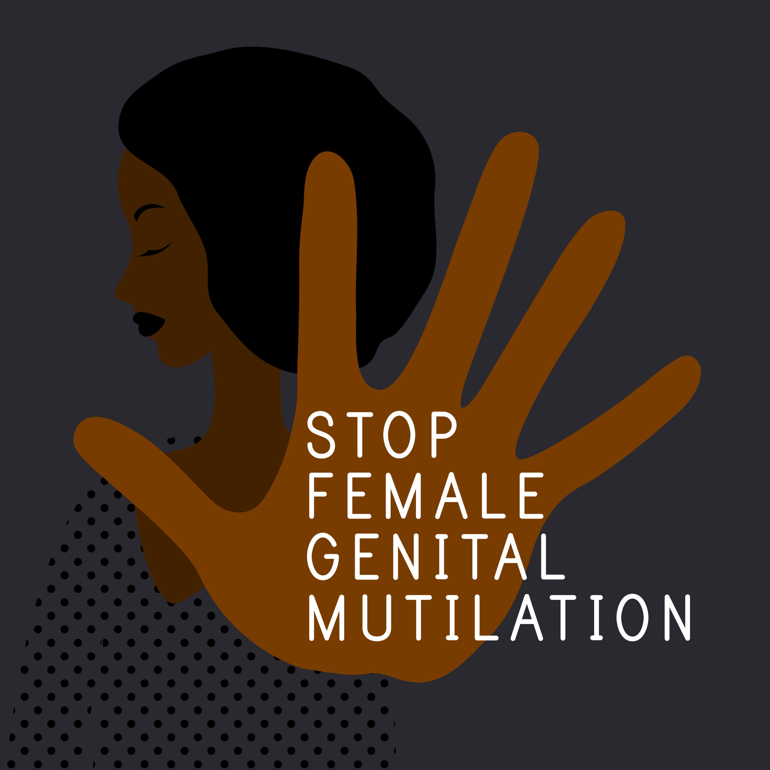 fgm